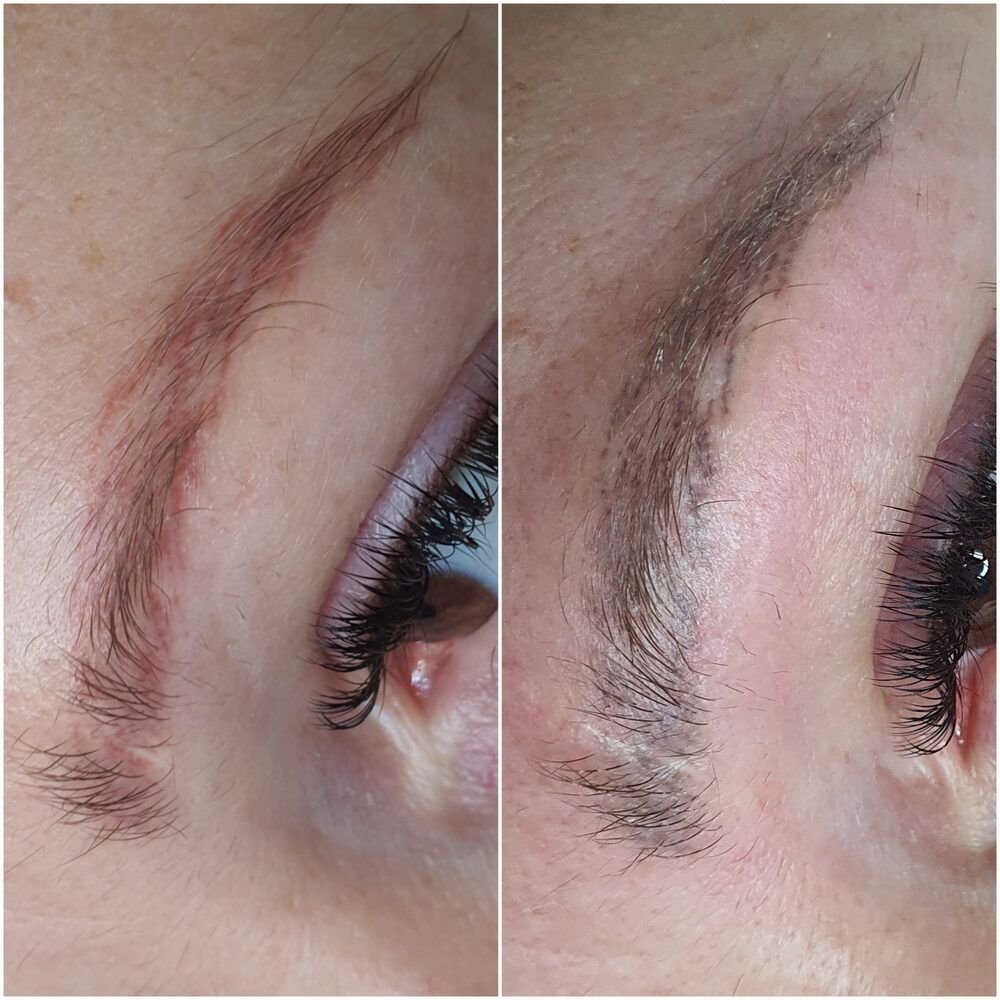 521440211f154f90bea4fdcff59a4d2f